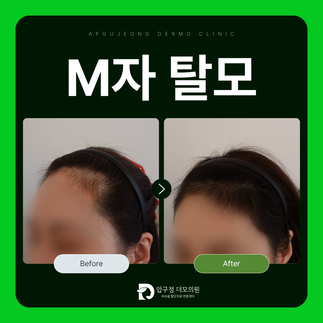 압구정더모의원 대표 이미지