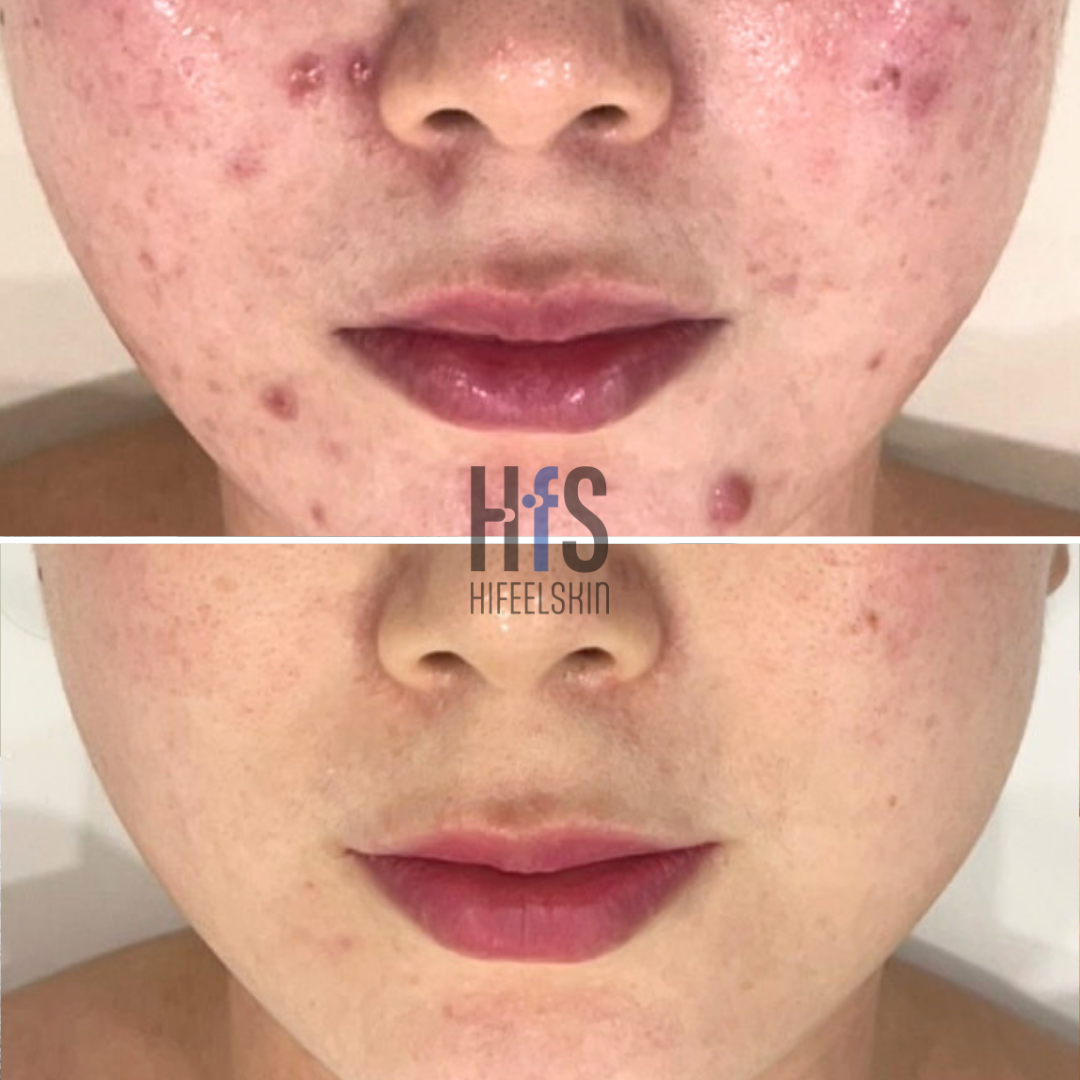 하이필스킨 강남선릉점 대표 이미지