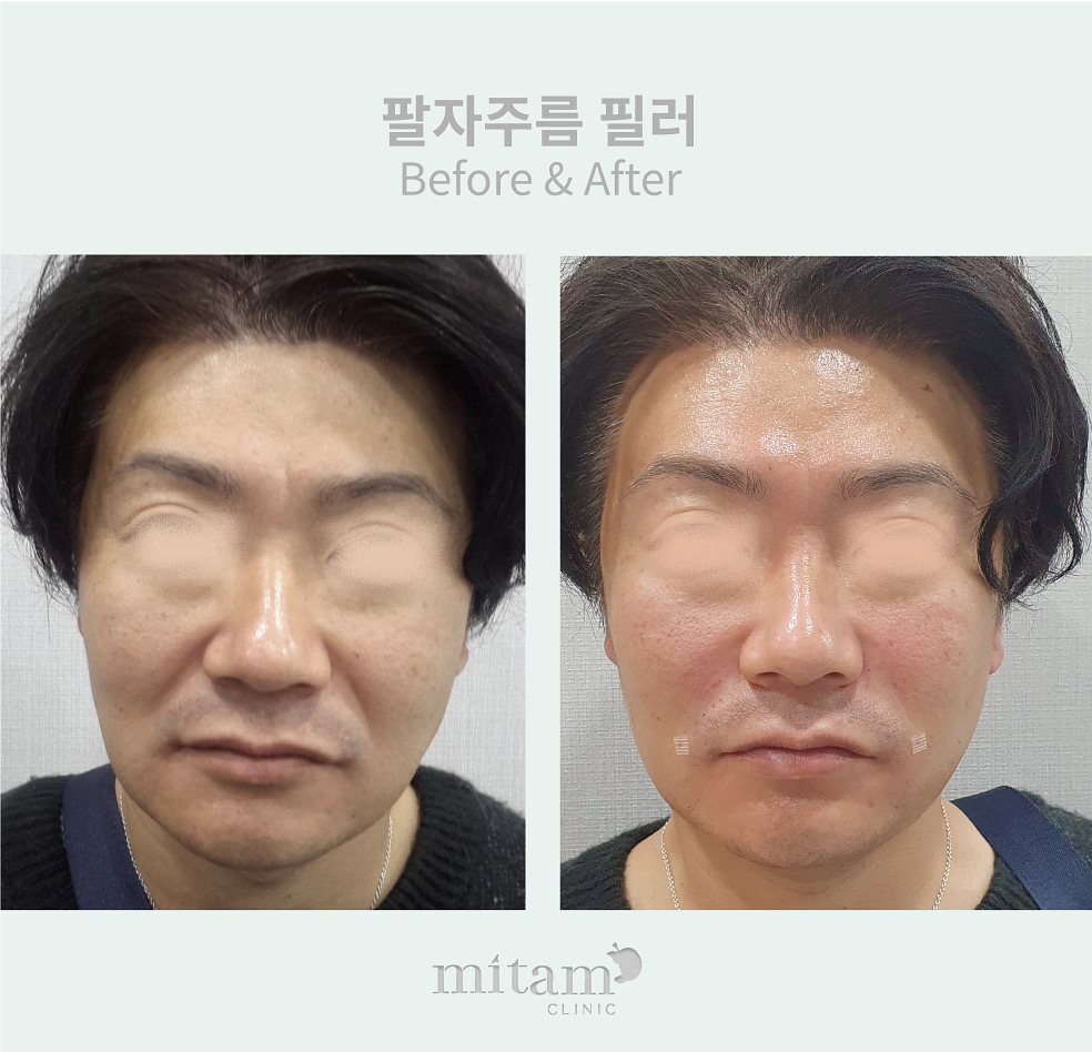아름다운미탐의원 명동 대표 이미지