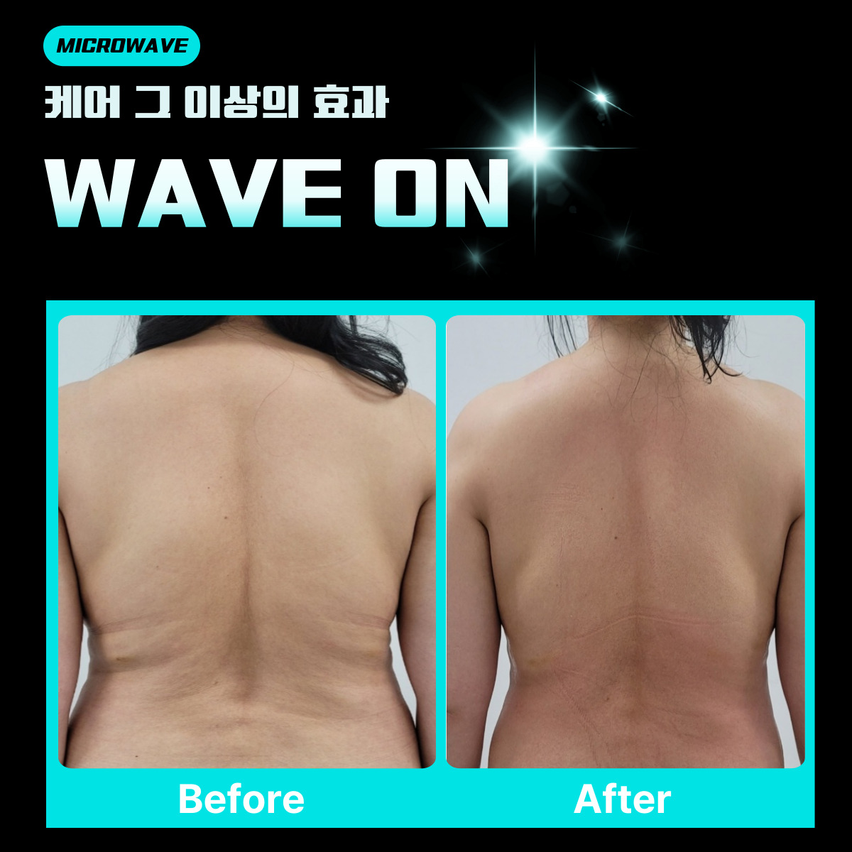 블레싱스킨케어 대표 이미지