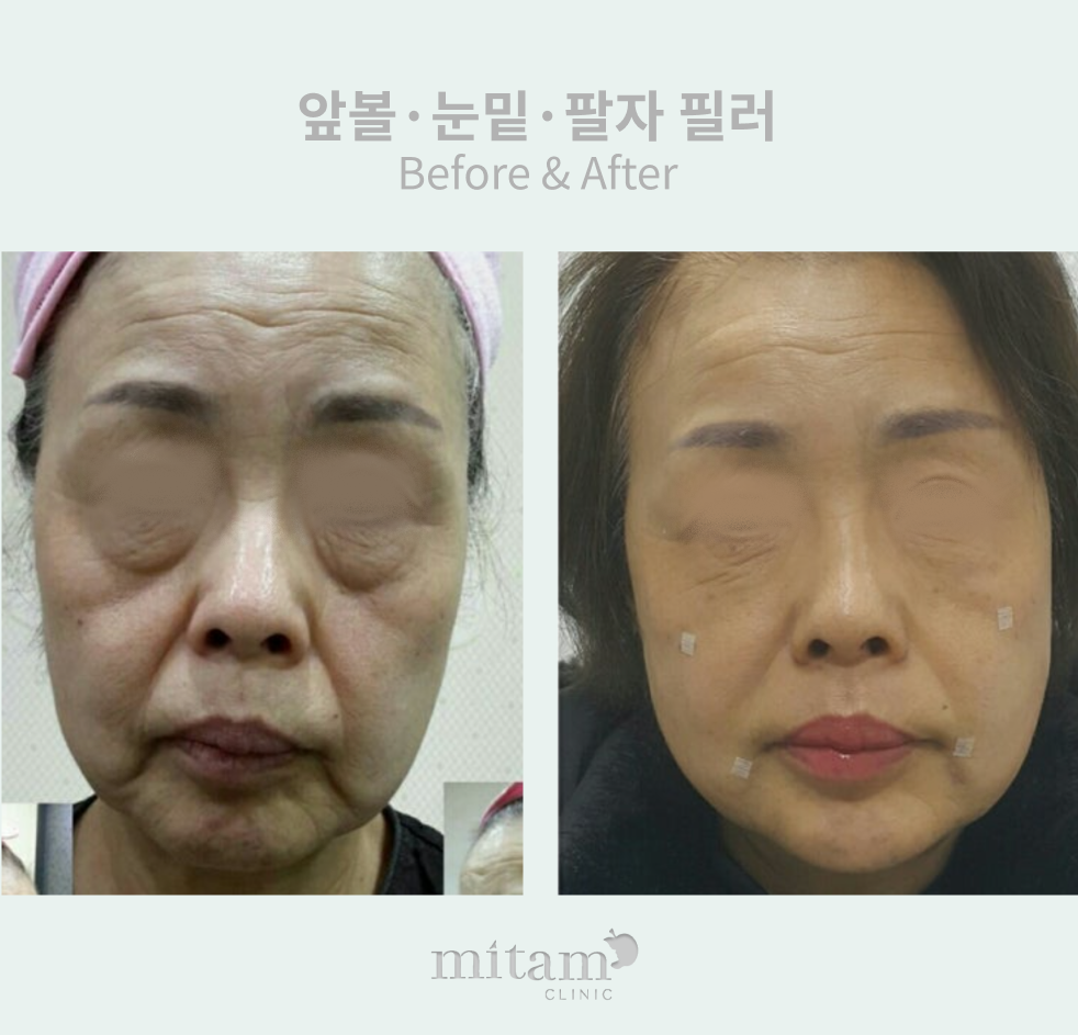 아름다운미탐의원 명동 대표 이미지