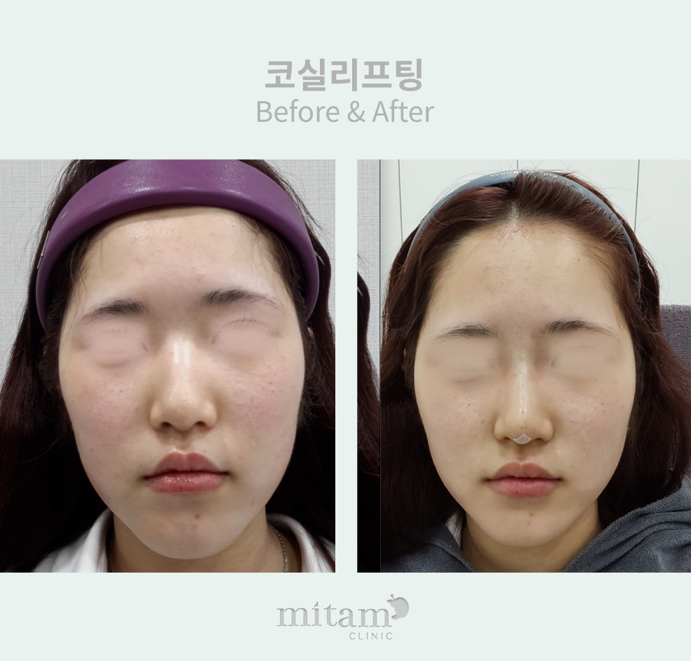 아름다운미탐의원 명동 대표 이미지
