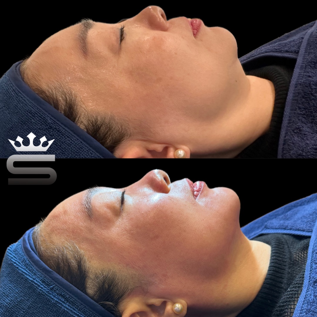 바비엔드 대표 이미지