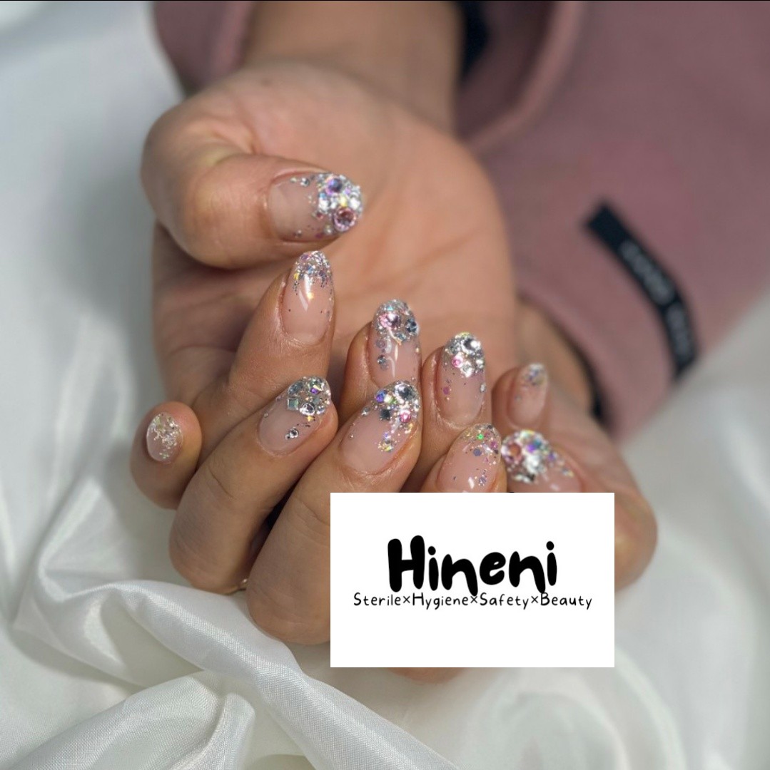 히네니 문제성 발톱 대표 이미지