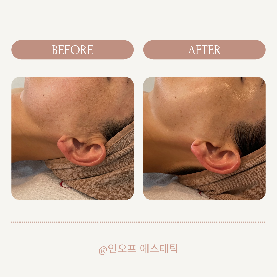 인오프 대표 이미지