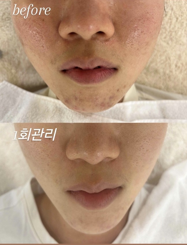 더고운피부에스테틱 대표 이미지
