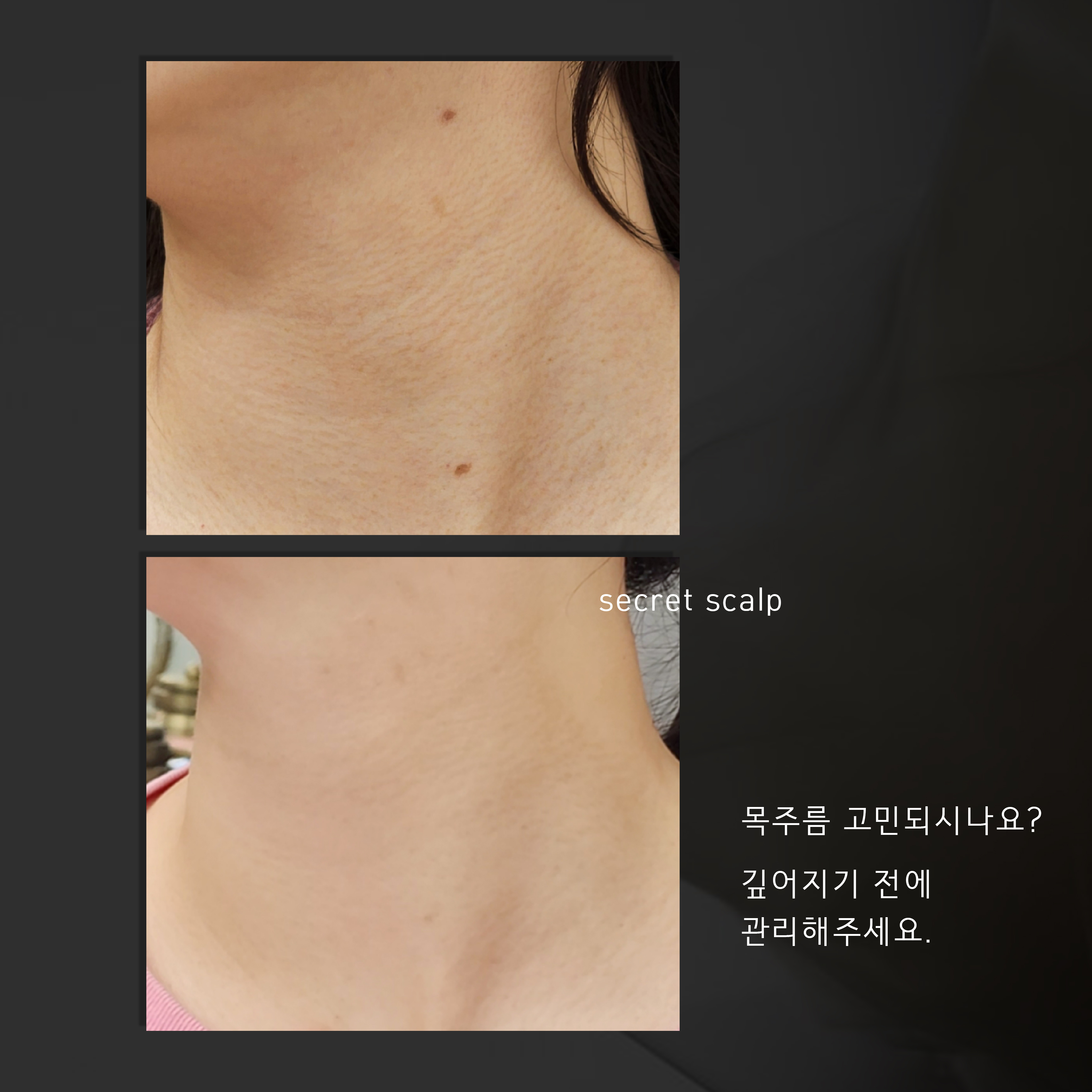 시크릿스칼프 대표 이미지