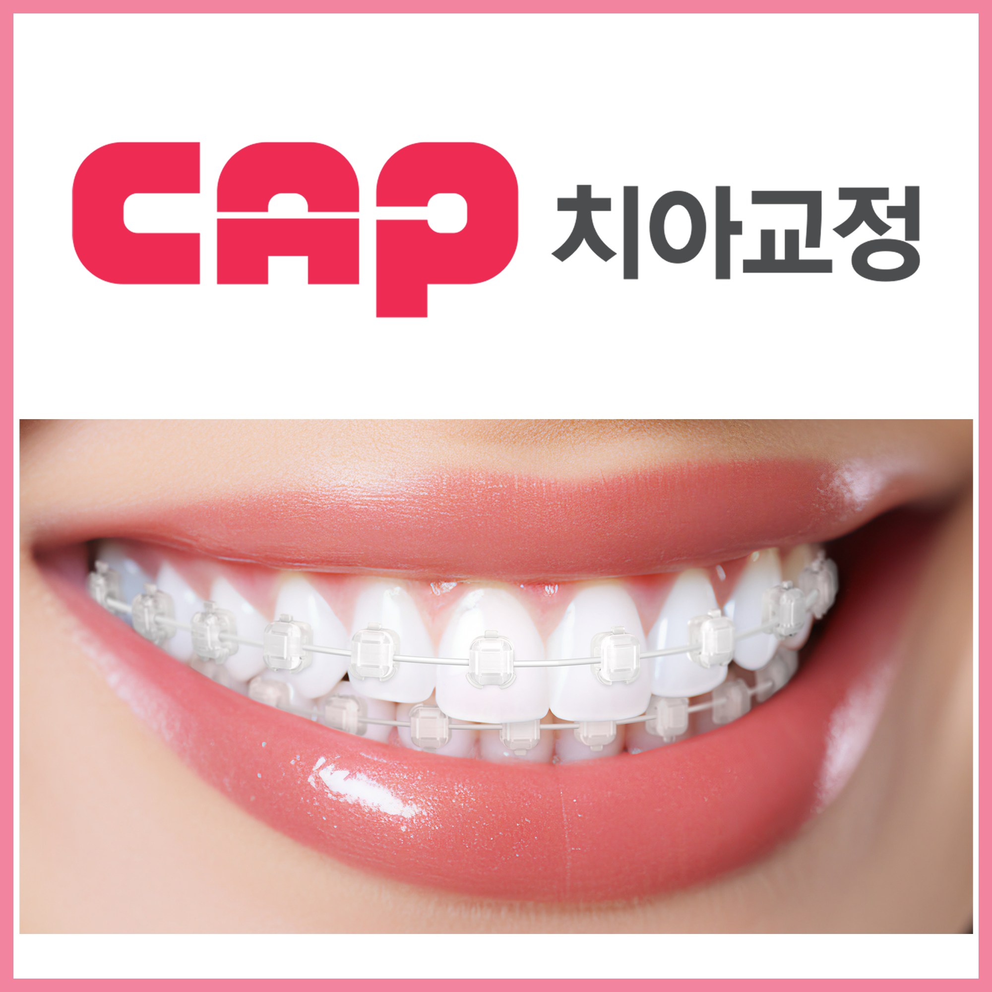 연세정교한캡치과 대표 이미지