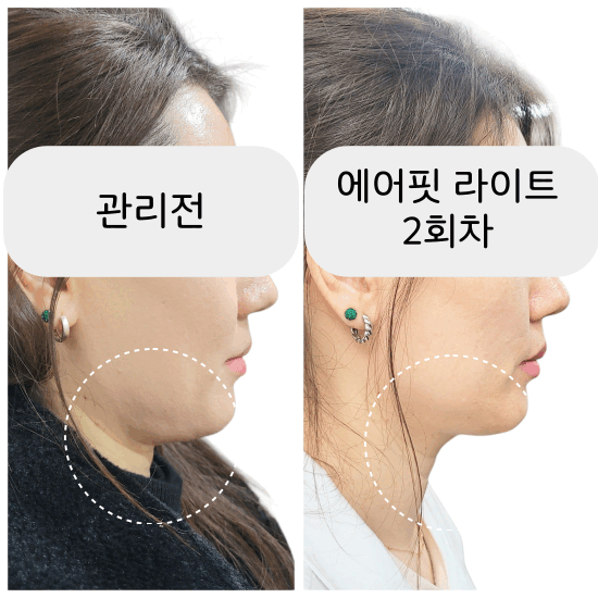 리바디라인 photo 2