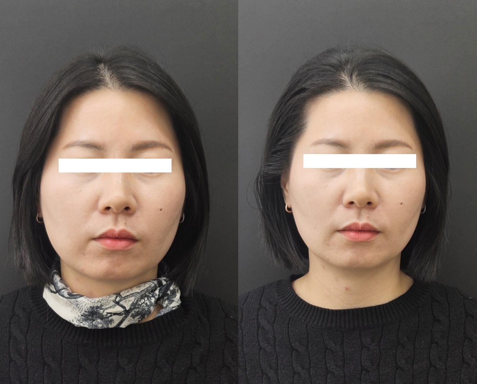 뷰티선셋 대표 이미지