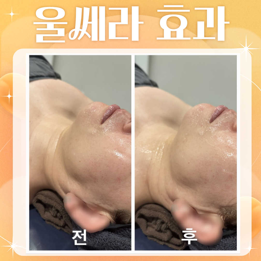 서윤피부맑음 명동점 대표 이미지