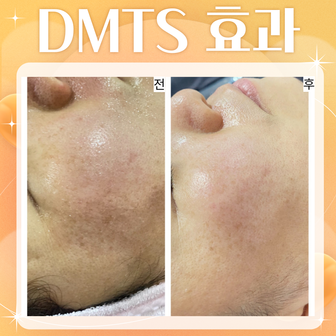 서윤피부맑음 명동점 대표 이미지