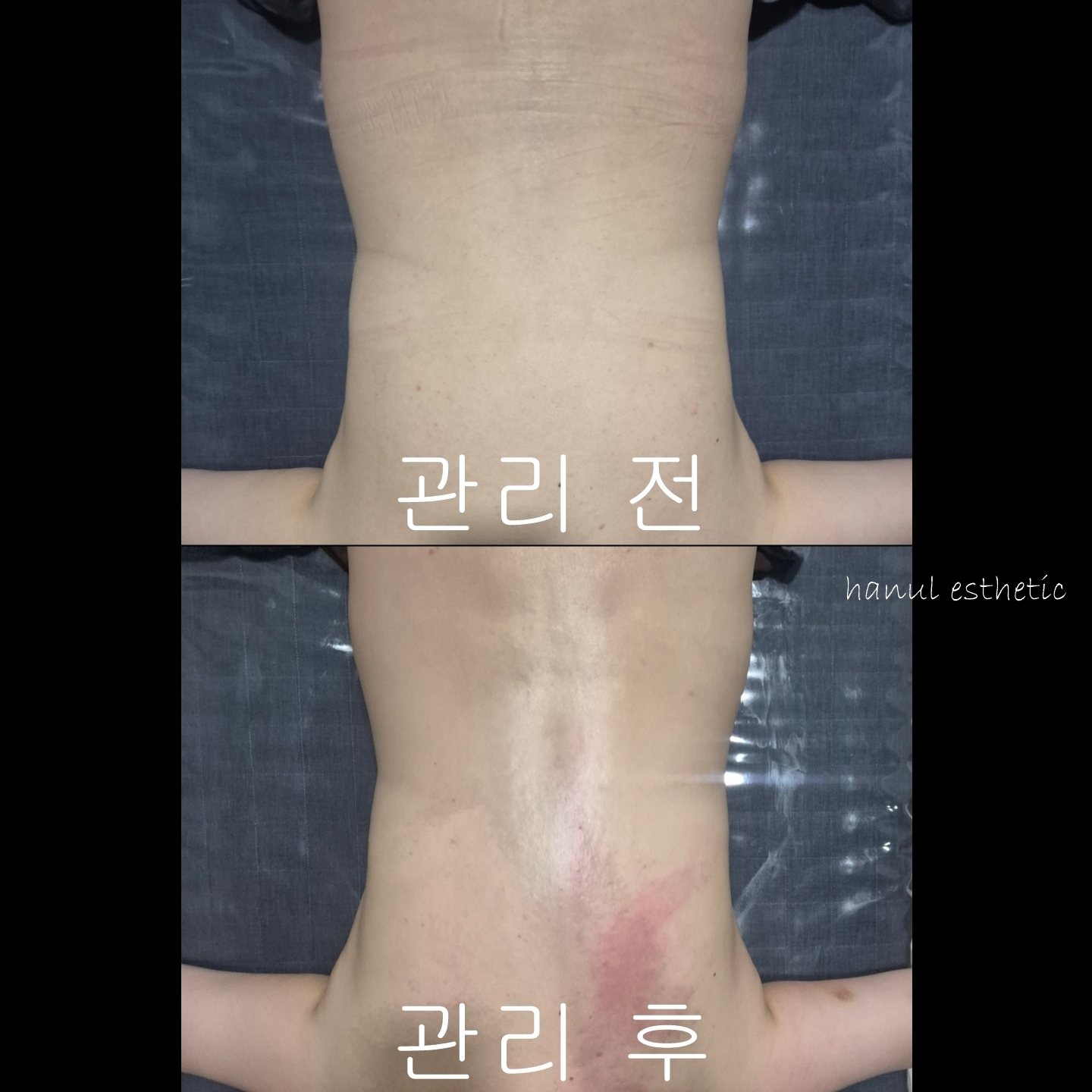 한울에스테틱 대표 이미지