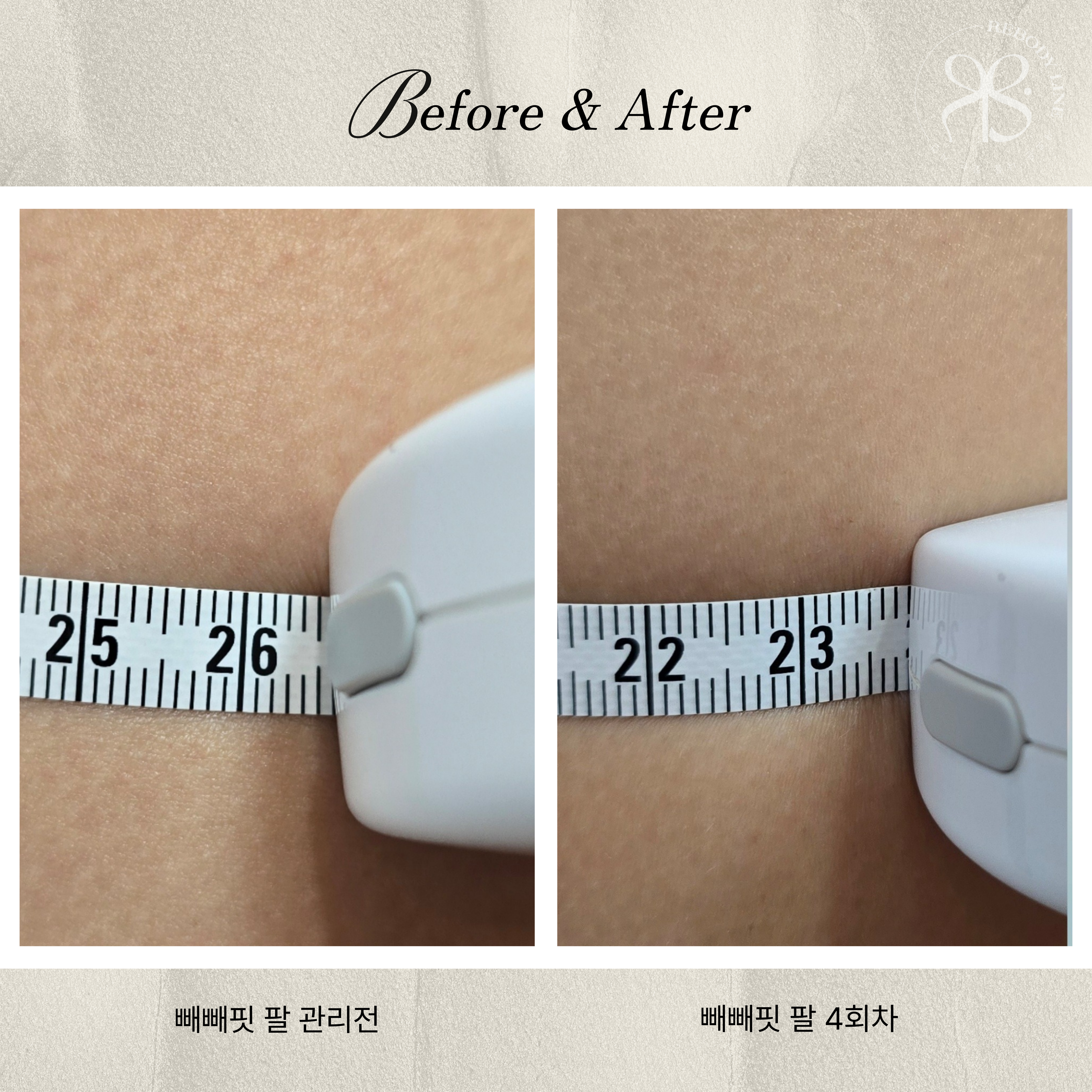 리바디라인 photo 8