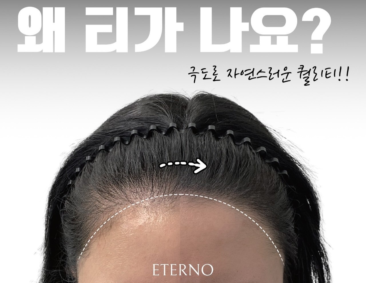 에테르노 대표 이미지