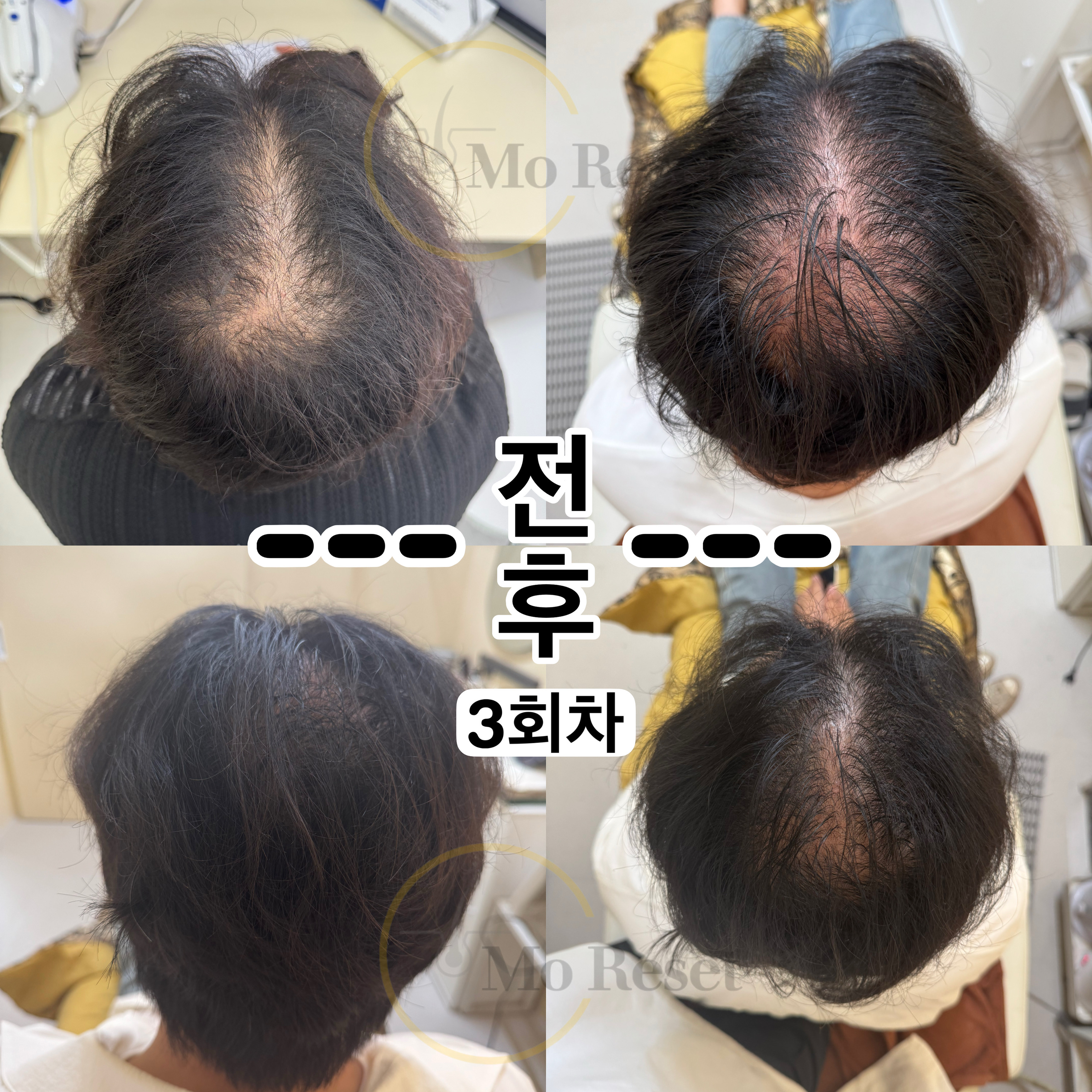 모리셋두피재생센터 창원점 대표 이미지