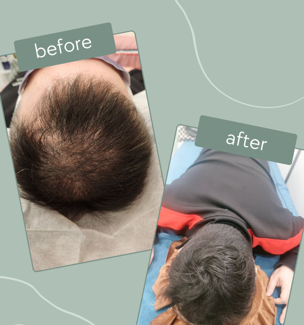 에테르노 대표 이미지