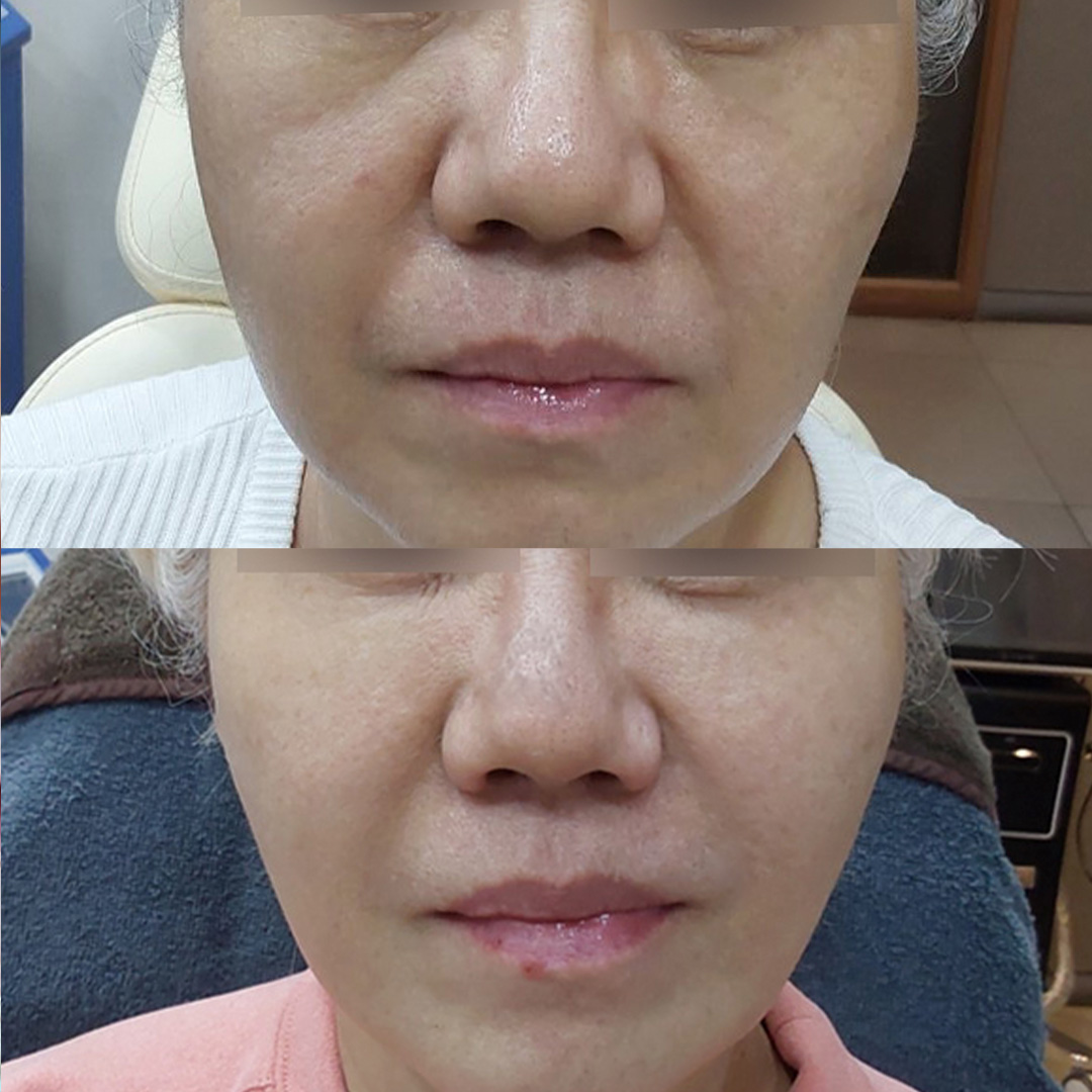 어뉴의원 대표 이미지