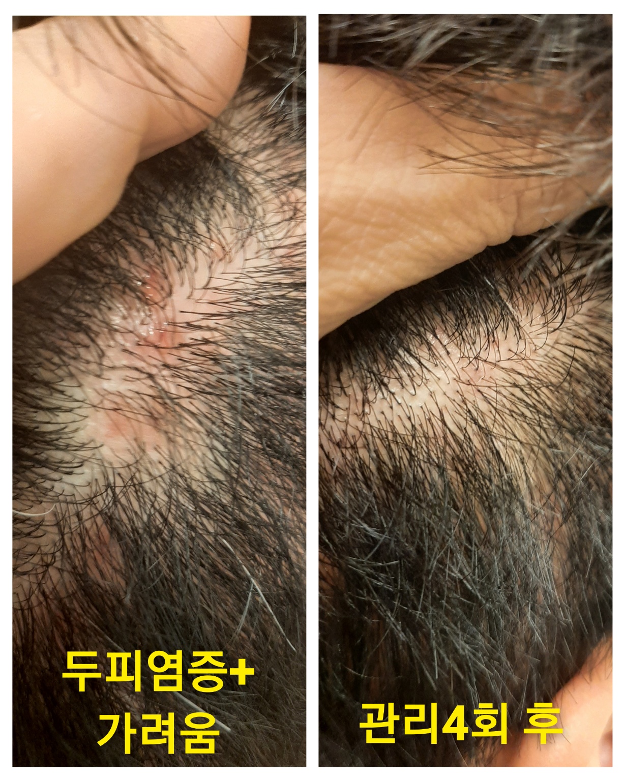 숲칼프 가산두피탈모전문센터 대표 이미지