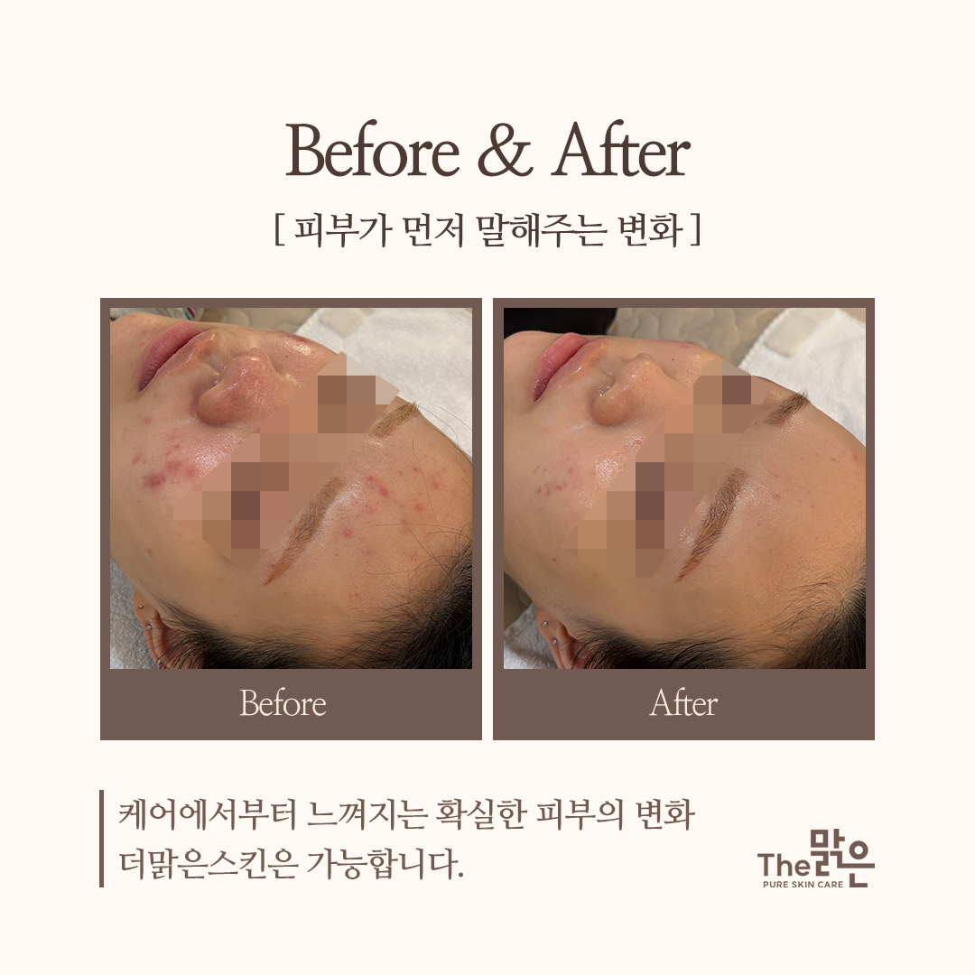 더맑은스킨 대표 이미지