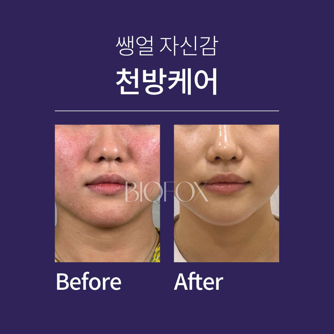 린다아이래쉬 photo 8