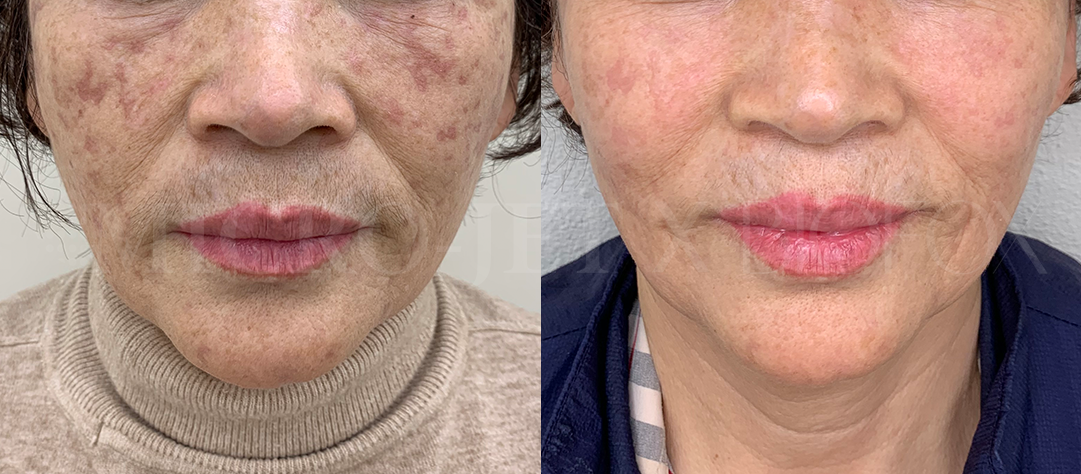 루미힐에스테틱 대표 이미지