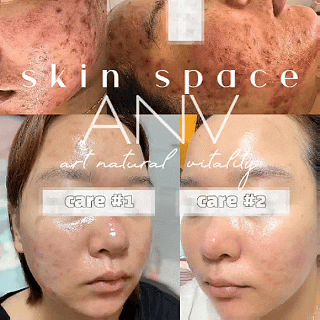 아앤브 스킨스페이스 다산점 대표 이미지