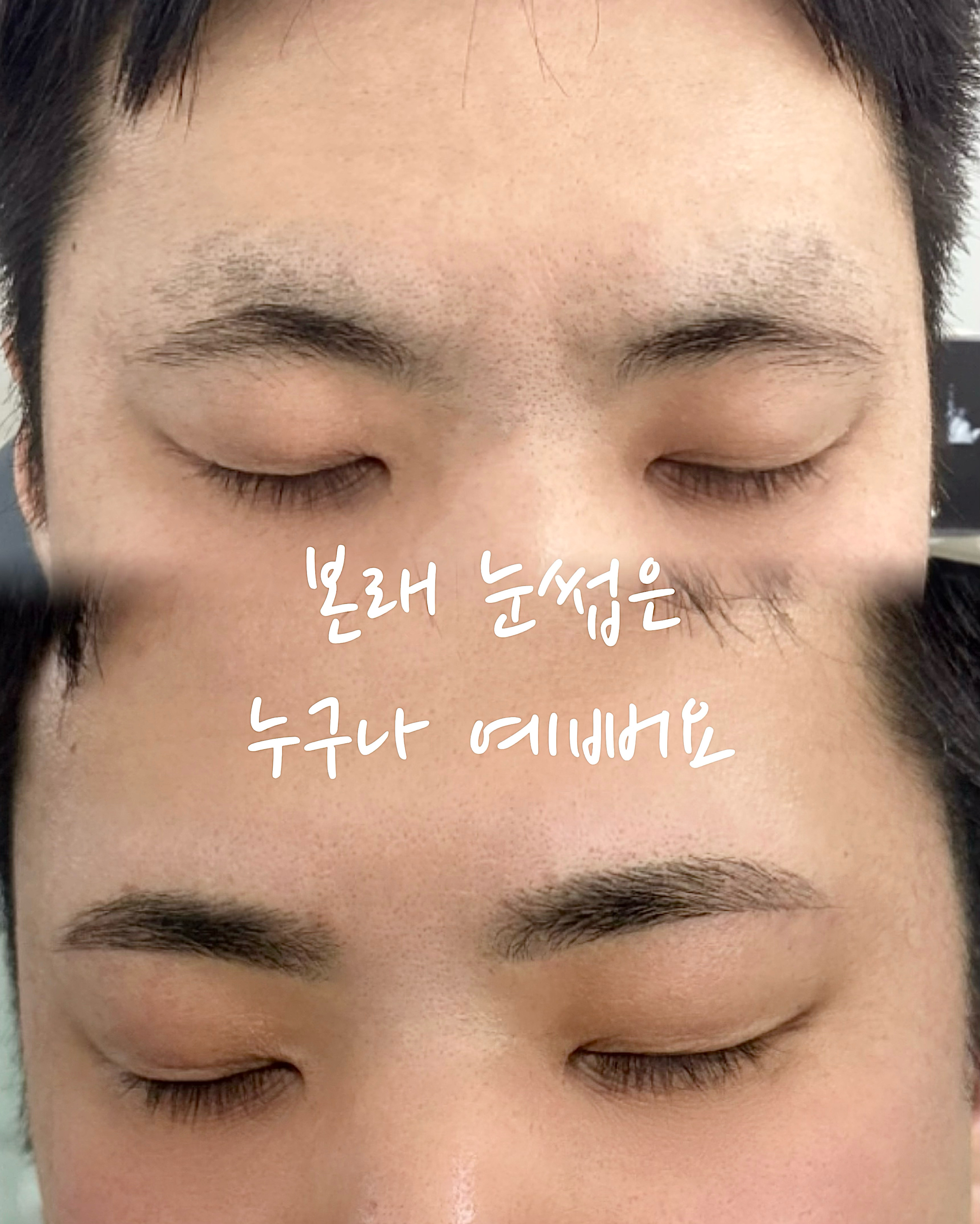 르바이미 뷰티성형 압구정 대표 이미지