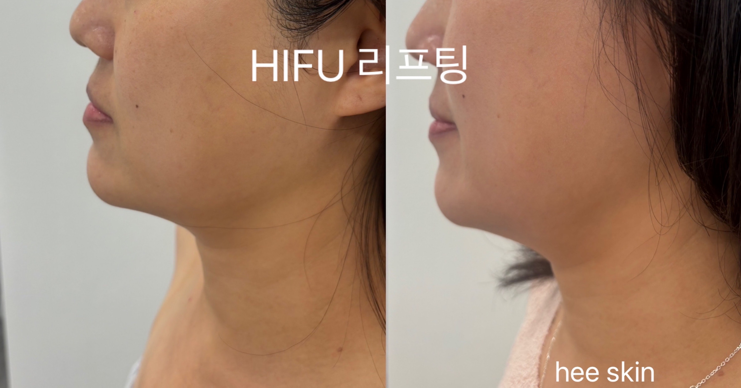 HEE SKIN 대표 이미지