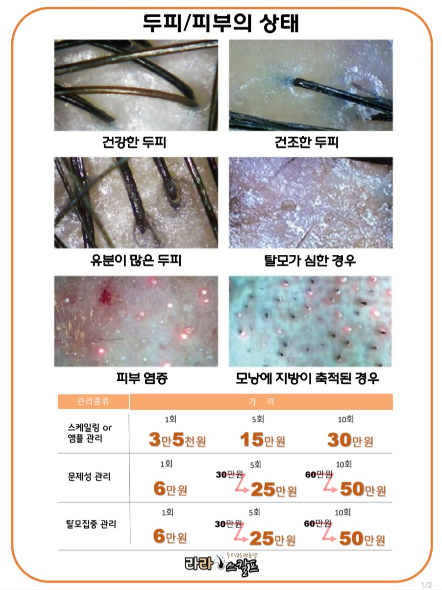 라라스칼프 대표 이미지