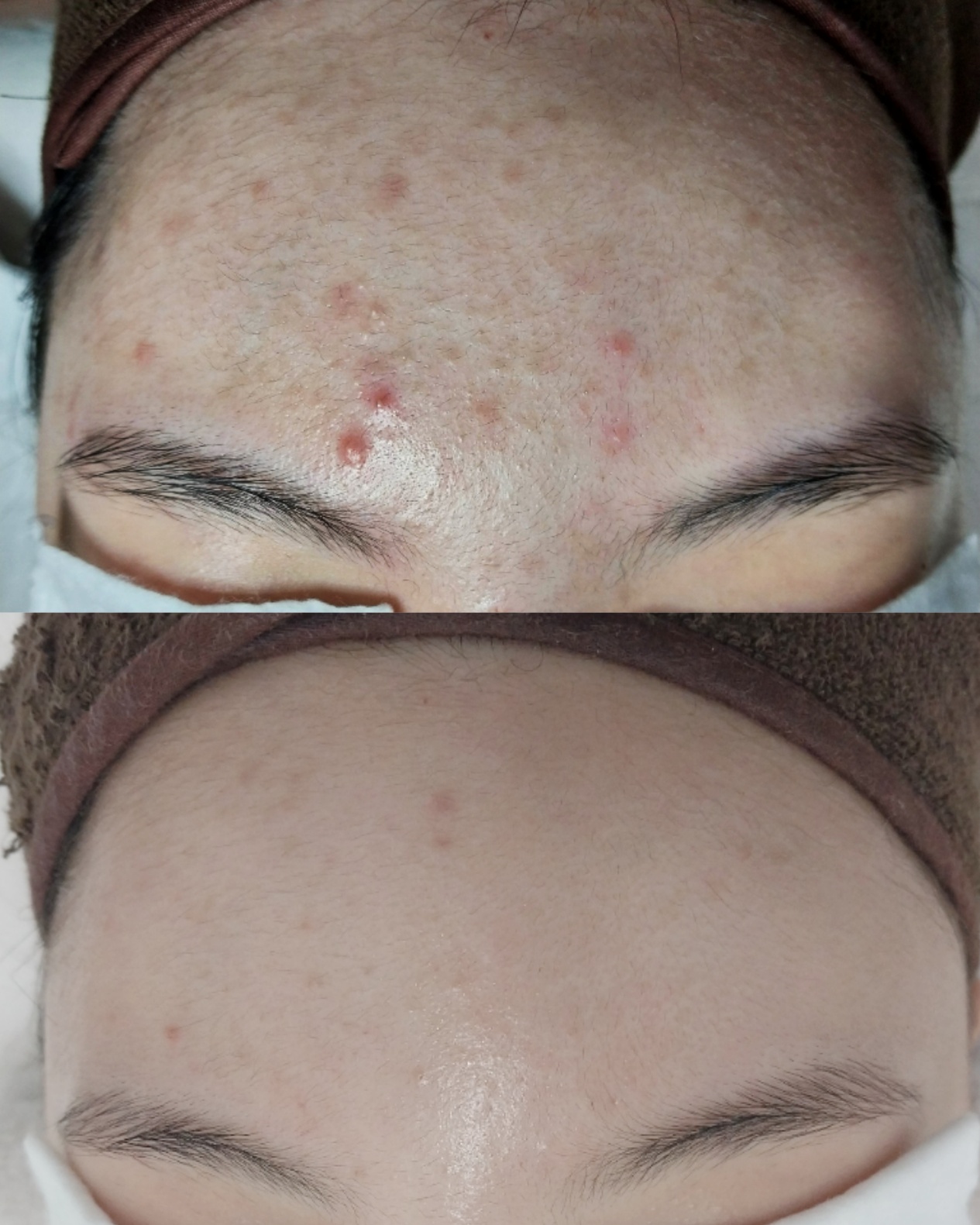 솜솜에스테틱 강남 선릉본점 대표 이미지