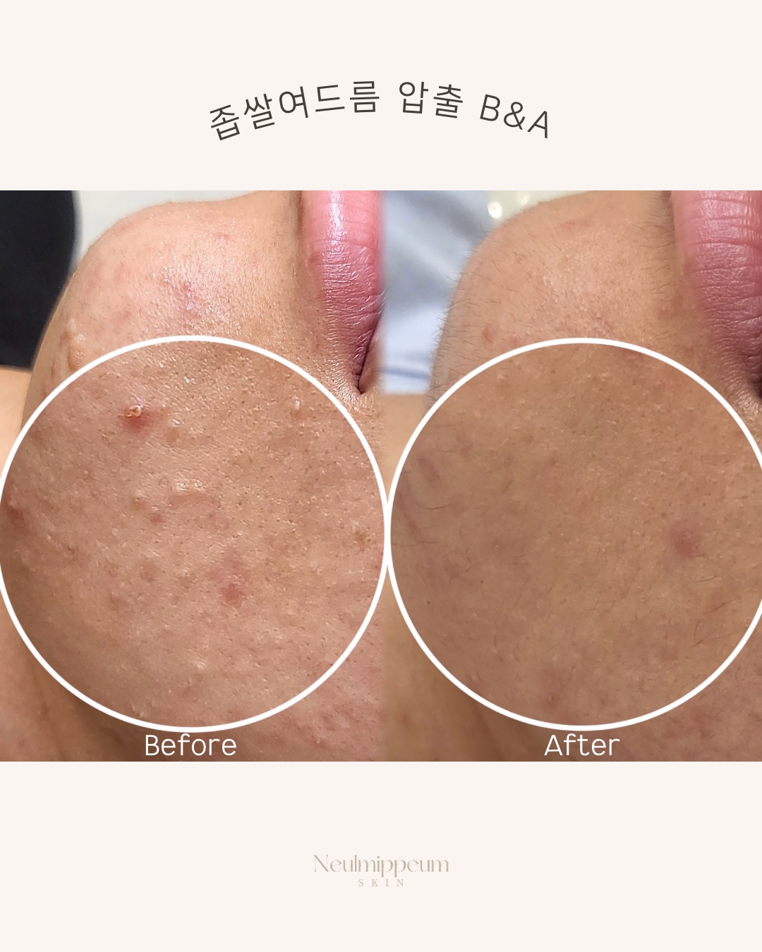늘미쁨스킨 대표 이미지