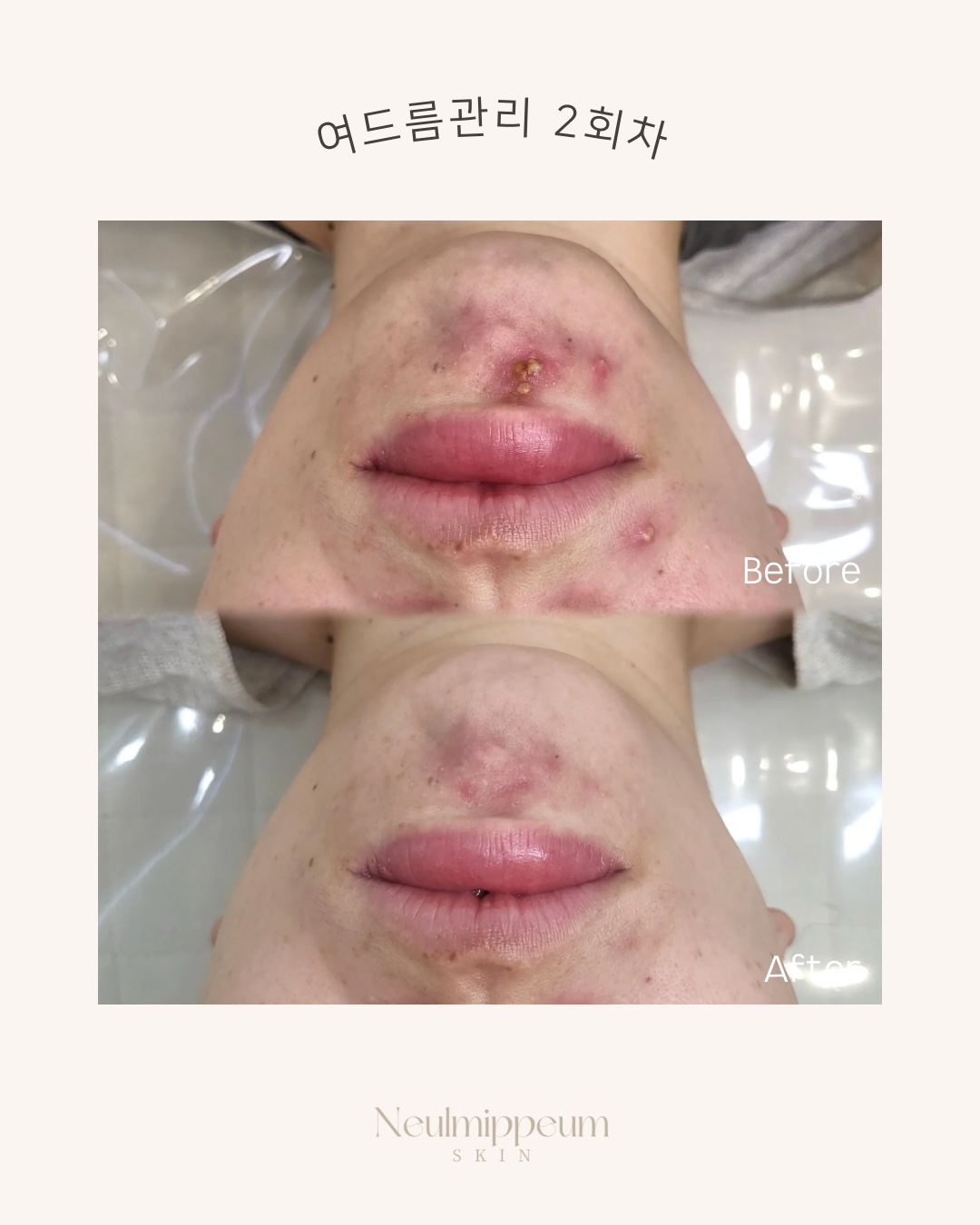 늘미쁨스킨 평택고덕본점 대표 이미지