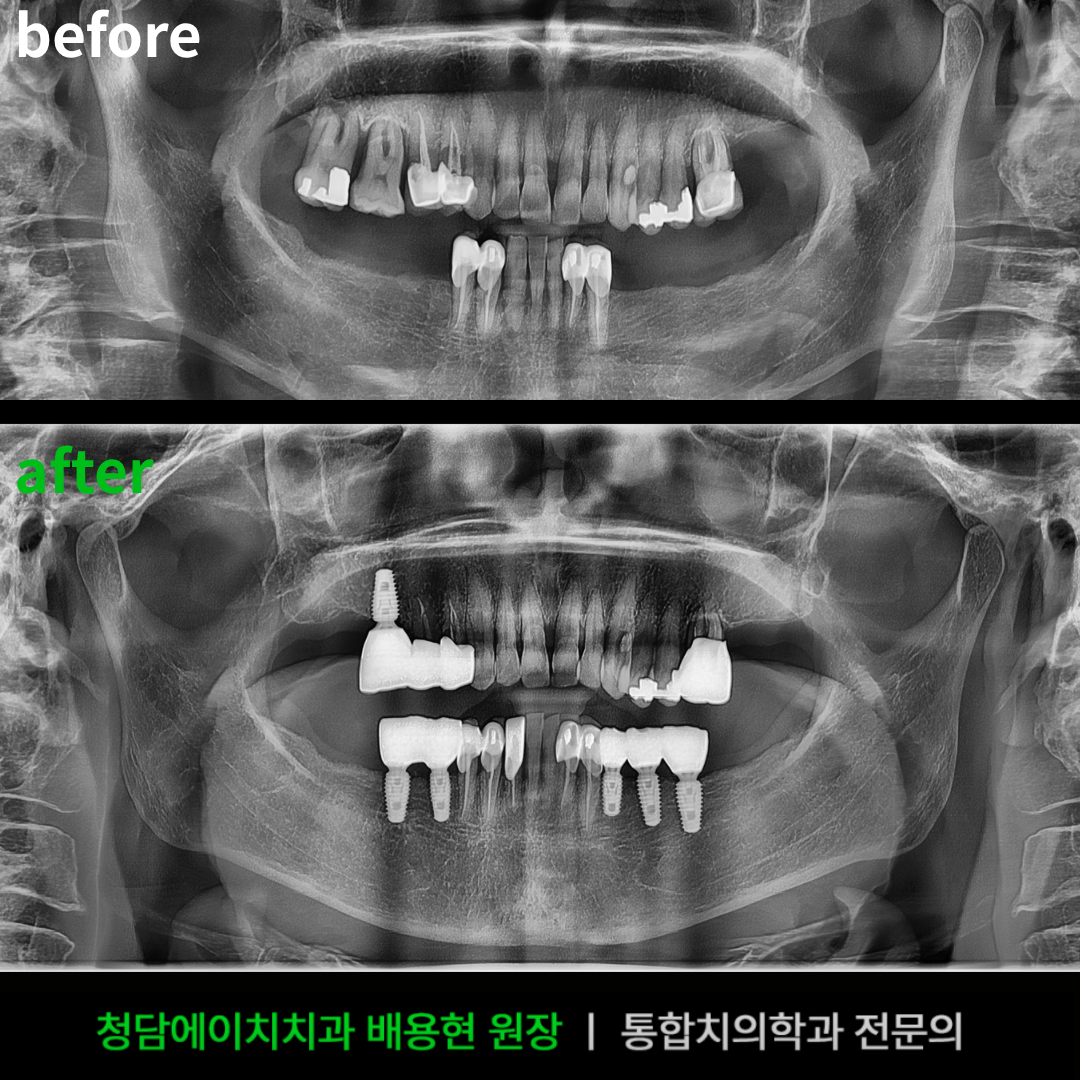 청담에이치치과의원 포항양덕점 대표 이미지