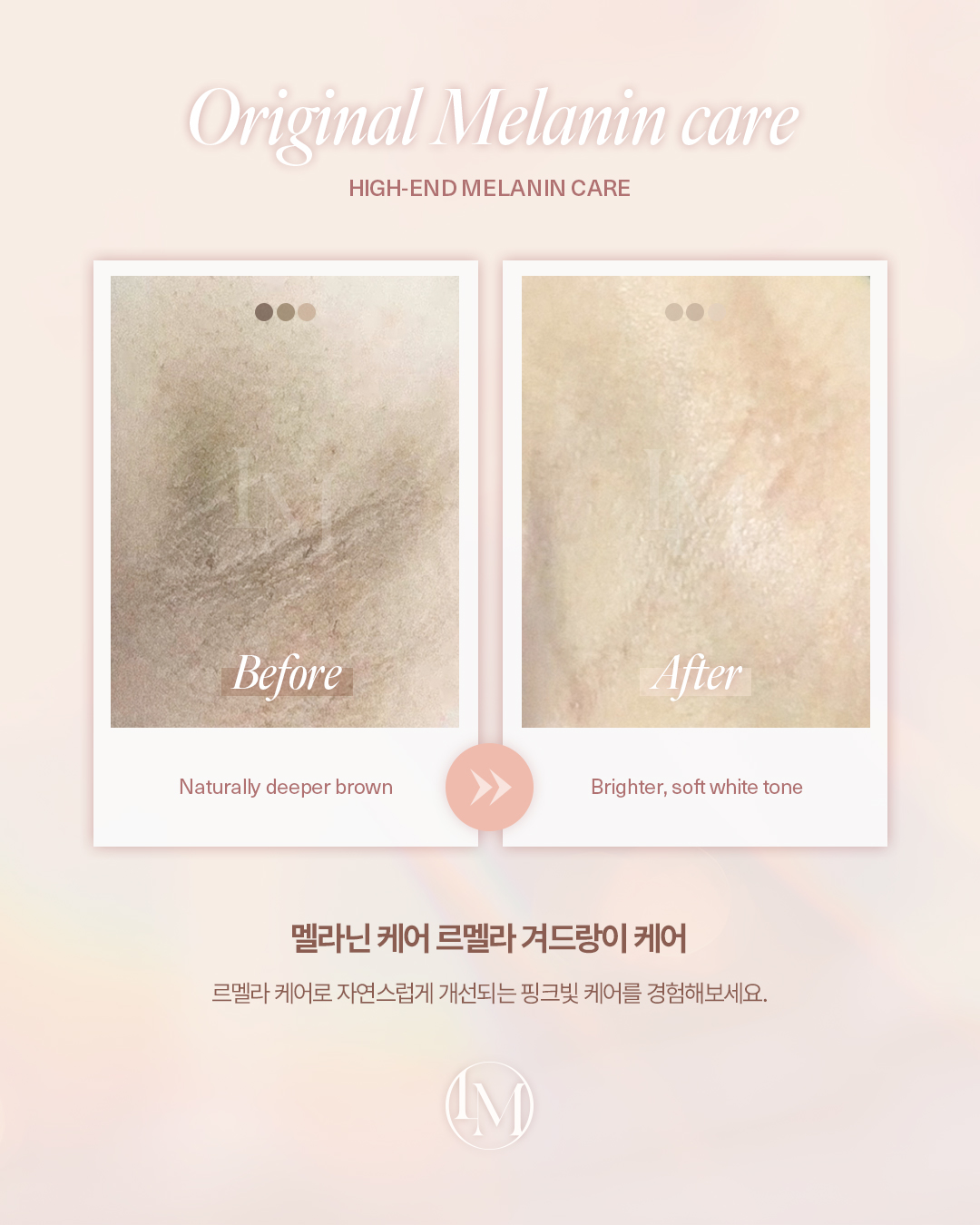온다연 슈가링왁싱 대표 이미지