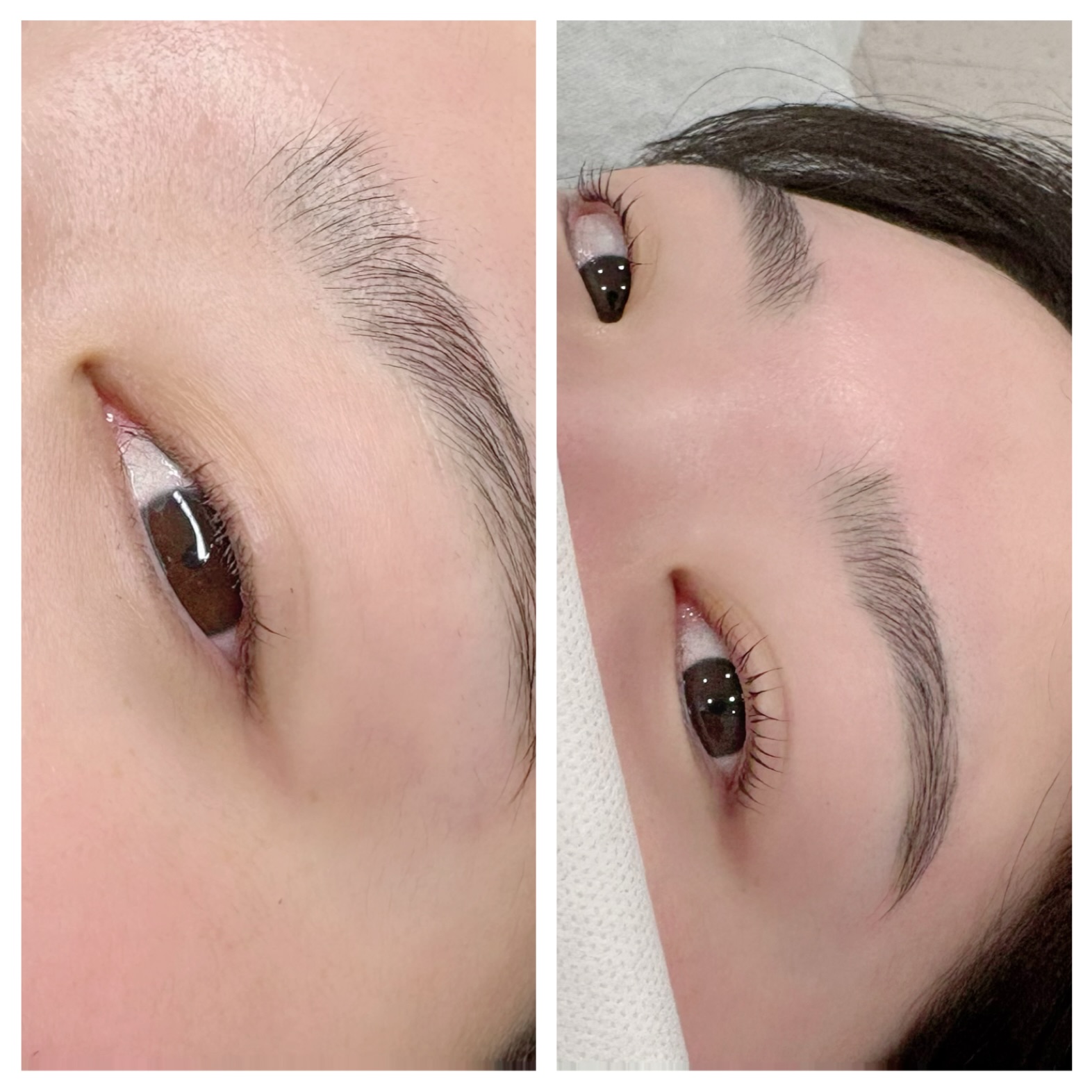 에끌라에스테틱 대표 이미지