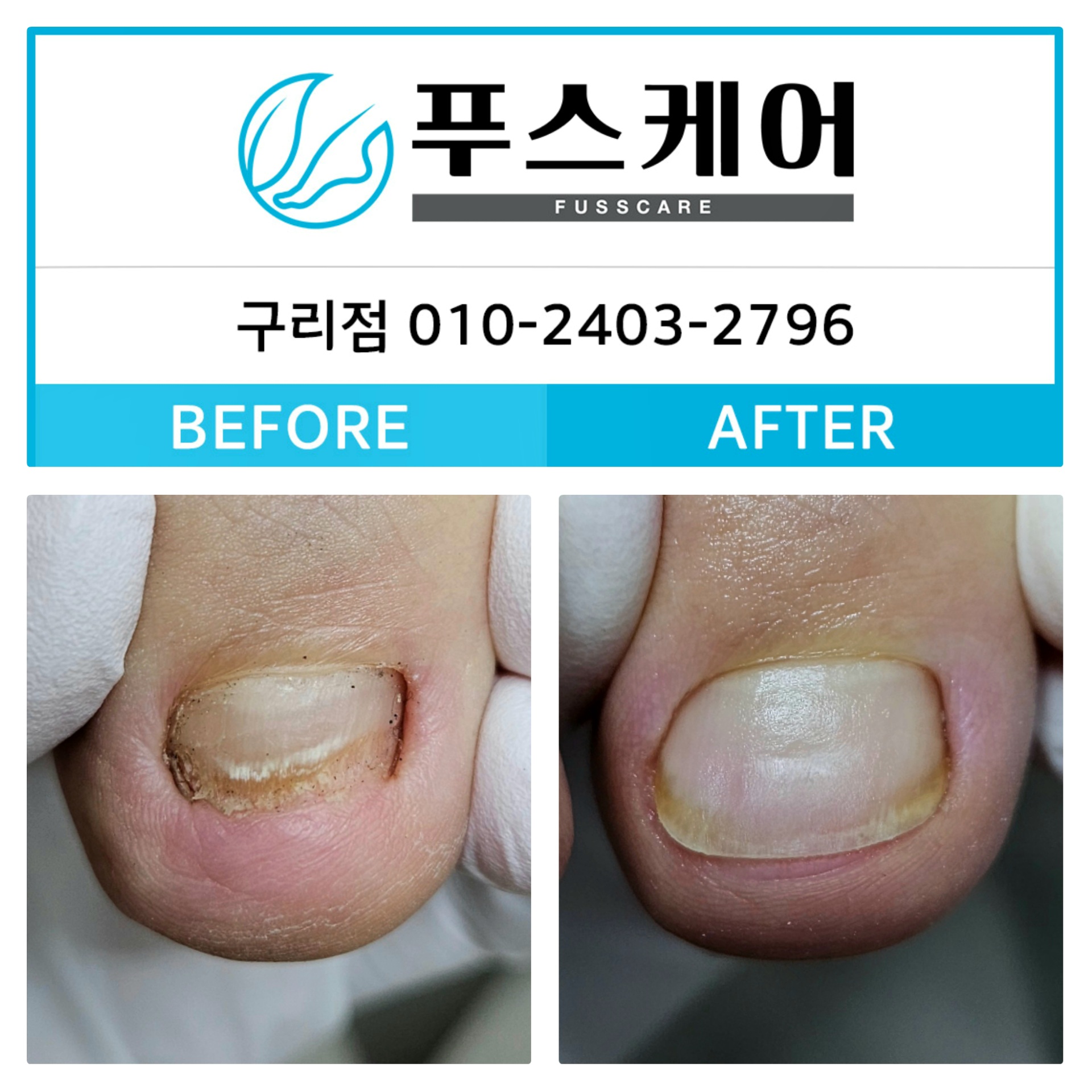 푸스케어 구리점 사진 3