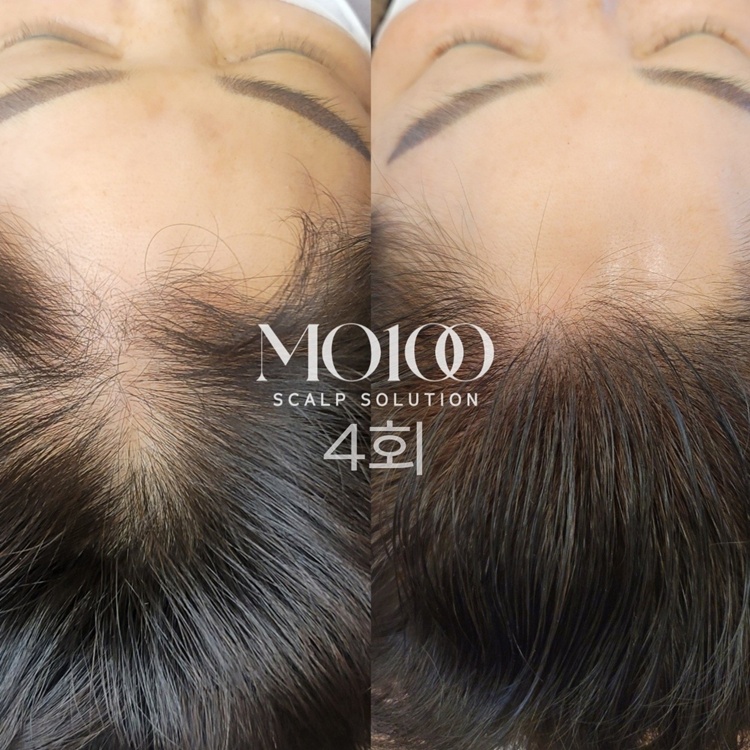 하티미미 논현점 대표 이미지