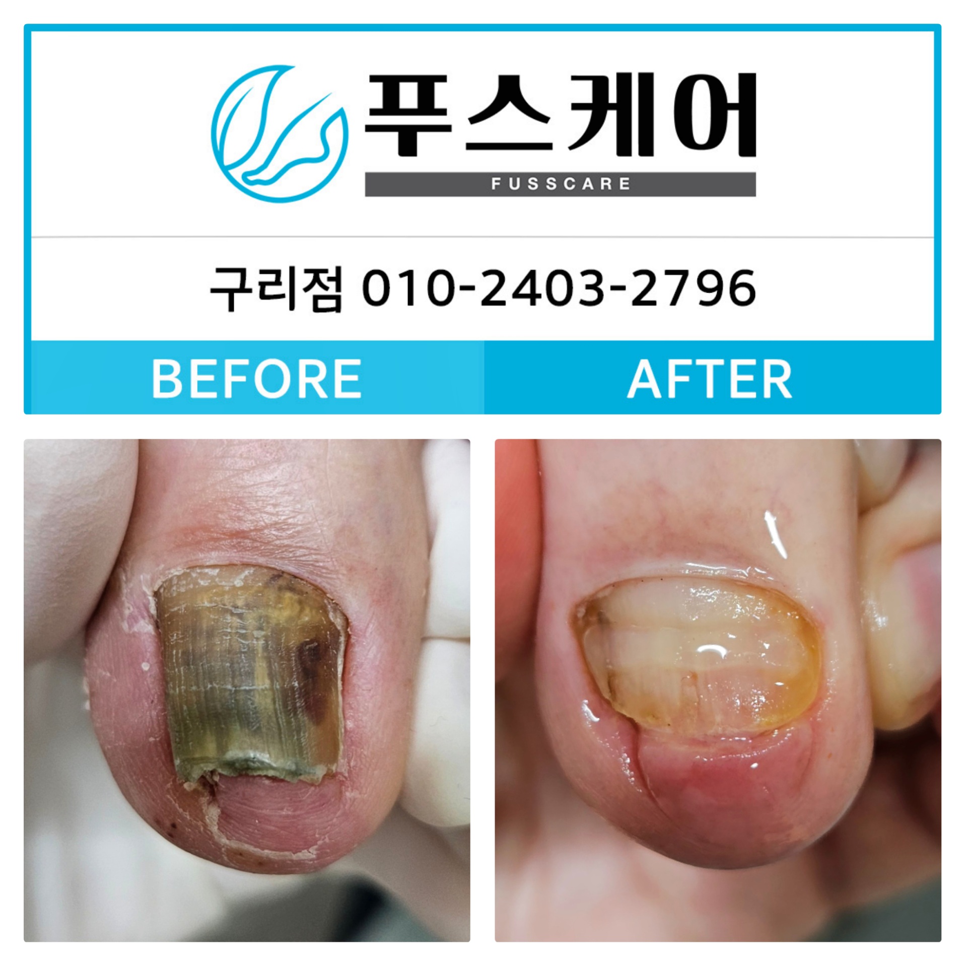 푸스케어 구리점 사진 2