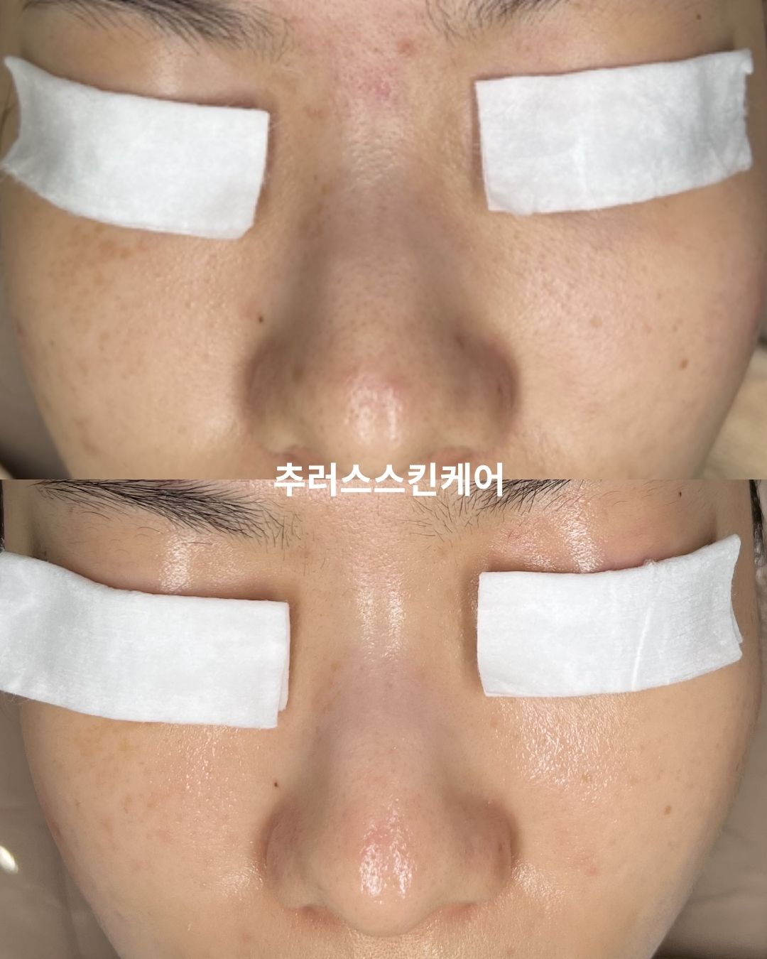 추러스스킨케어 대표 이미지
