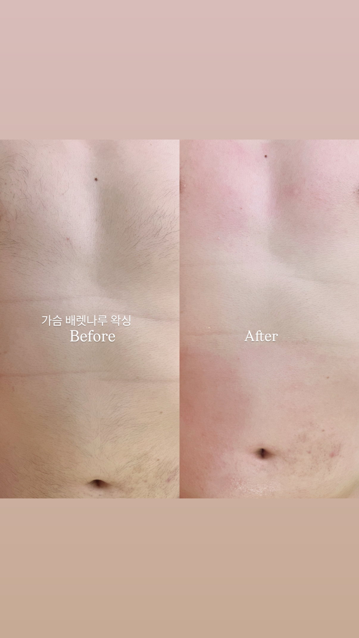 러빈뷰티 대표 이미지