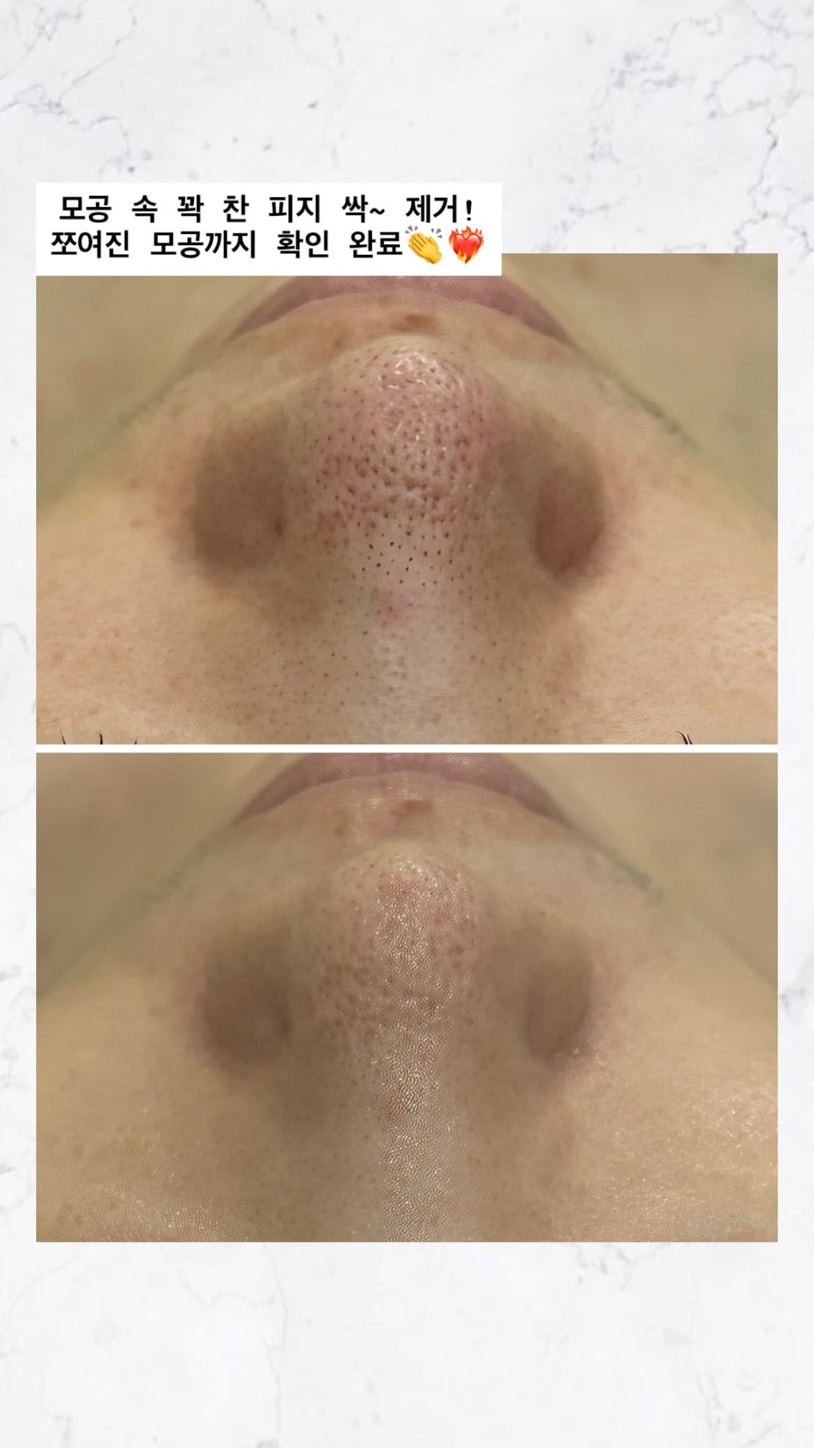 스킨 블룸 관리 사진