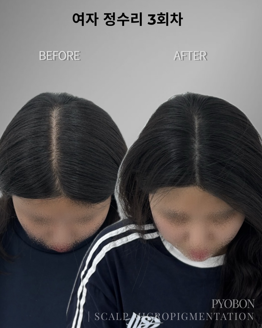 표본 대표 이미지