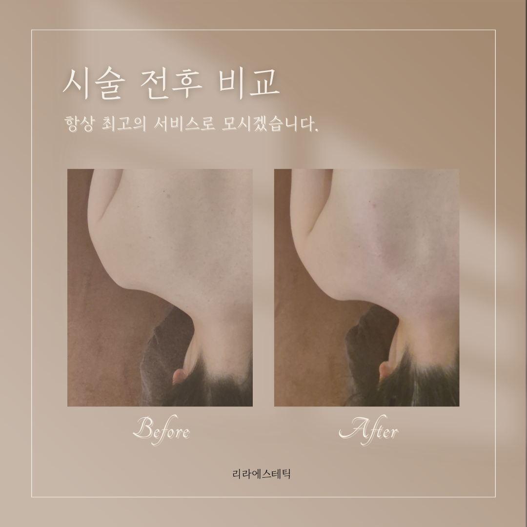 리라에스테틱 대표 이미지