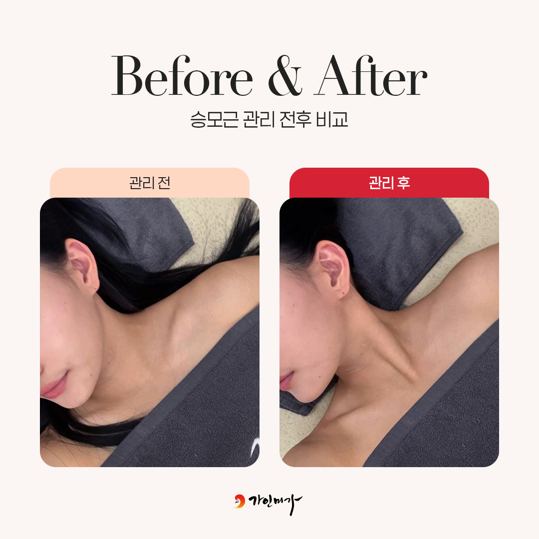 가인미가 인천구월점 대표 이미지