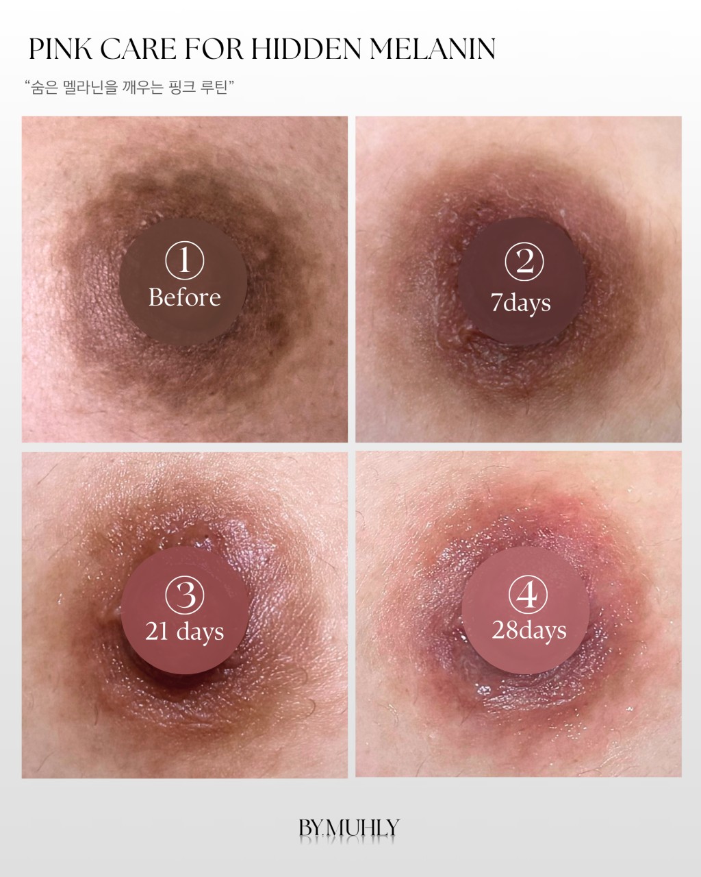 왁싱율&멜라닌케어 대표 이미지