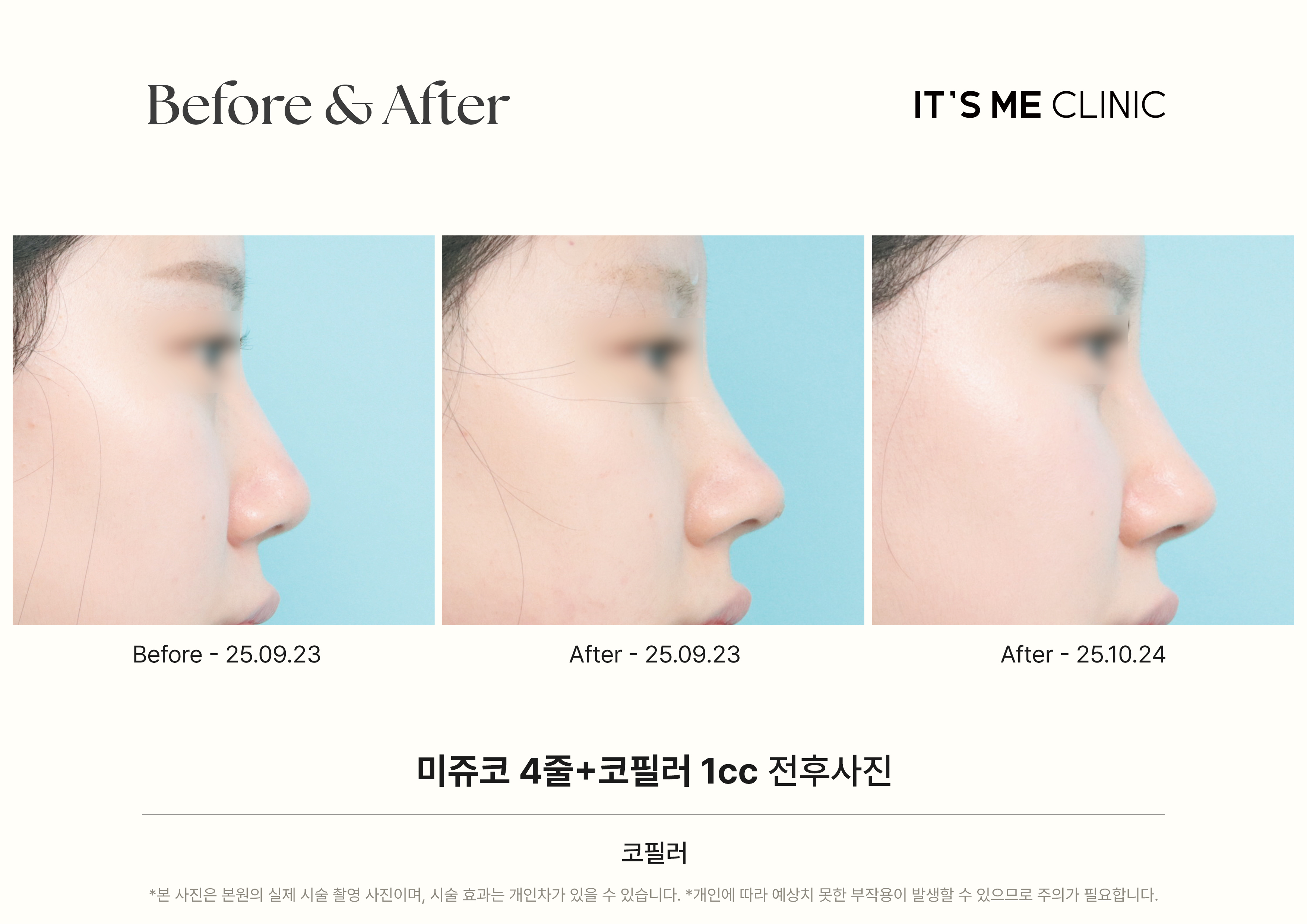잇츠미성형외과의원 대표 이미지