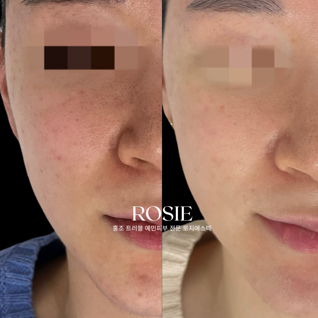 로지에스떼 대표 이미지