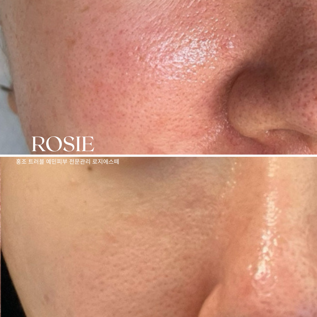 로지에스떼 대표 이미지