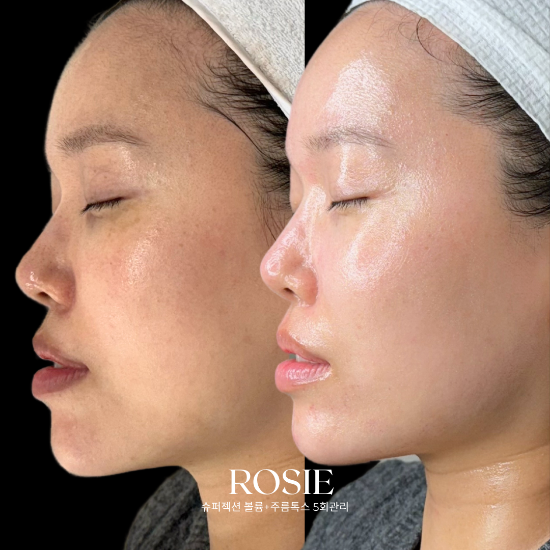 로지에스떼 대표 이미지